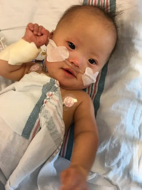 It Took Me 9 Months To Train My Down Syndrome Child To Breastfeed. This Is How We Did It It Took Me 9 Months To Train My Down Syndrome Child To Breastfeed. This Is How We Did It
